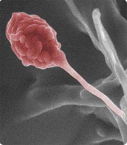 Colorized environmental scanning electron microscope photo of Gliocladium roseum, an endophytic fungus that produces biofuel.