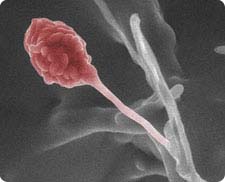 Colorized environmental scanning electron microscope photo of Gliocladium roseum, an endophytic fungus that produces biofuel.